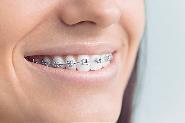Best Traditional Braces  in South Rosemary, NC
